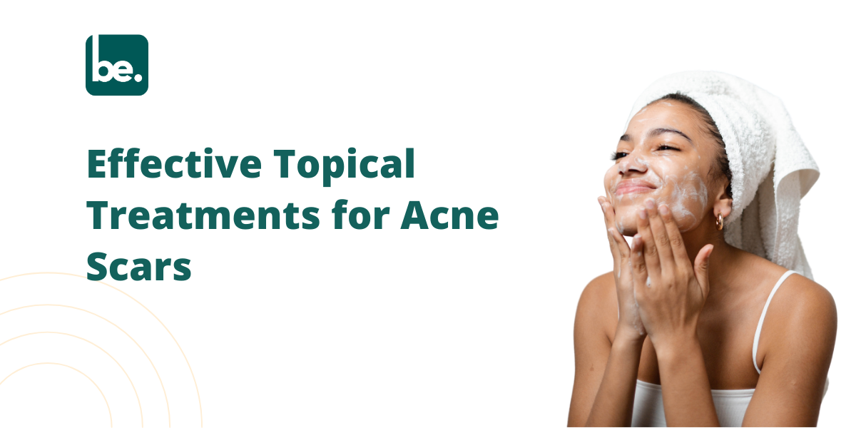 Effective Topical Treatments for Acne Scars