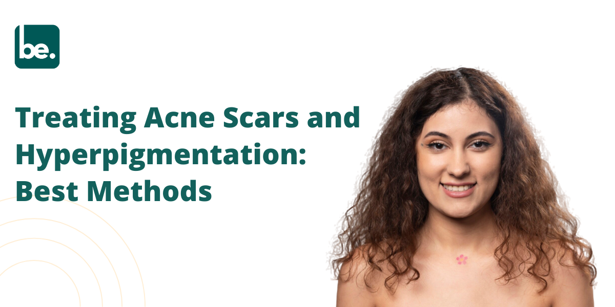 Treating Acne Scars and Hyperpigmentation: Best Methods